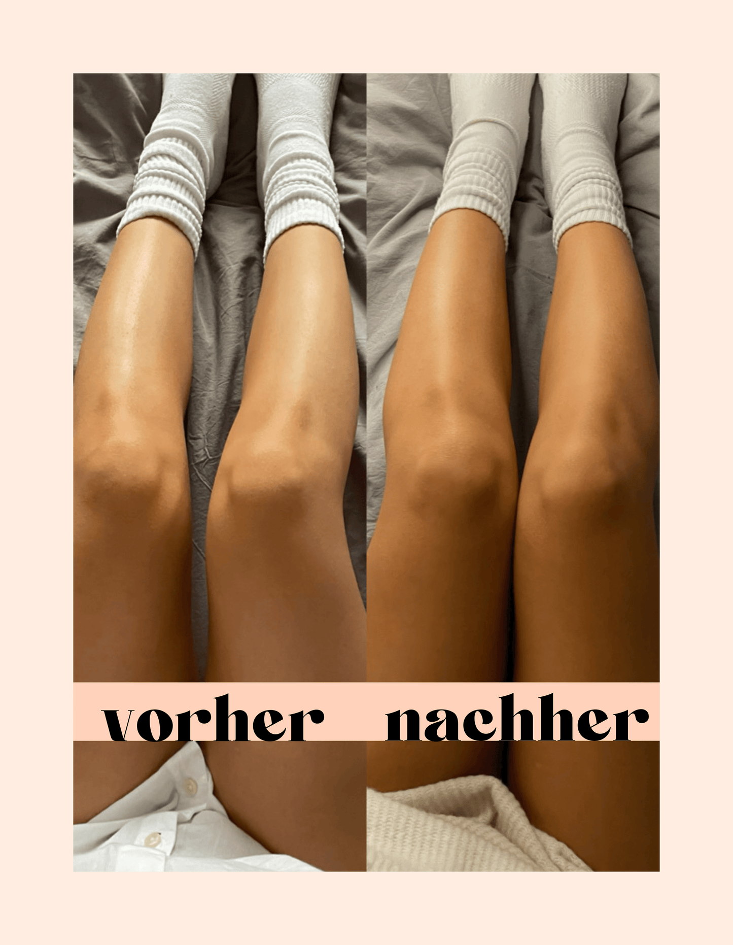 nüdes medium