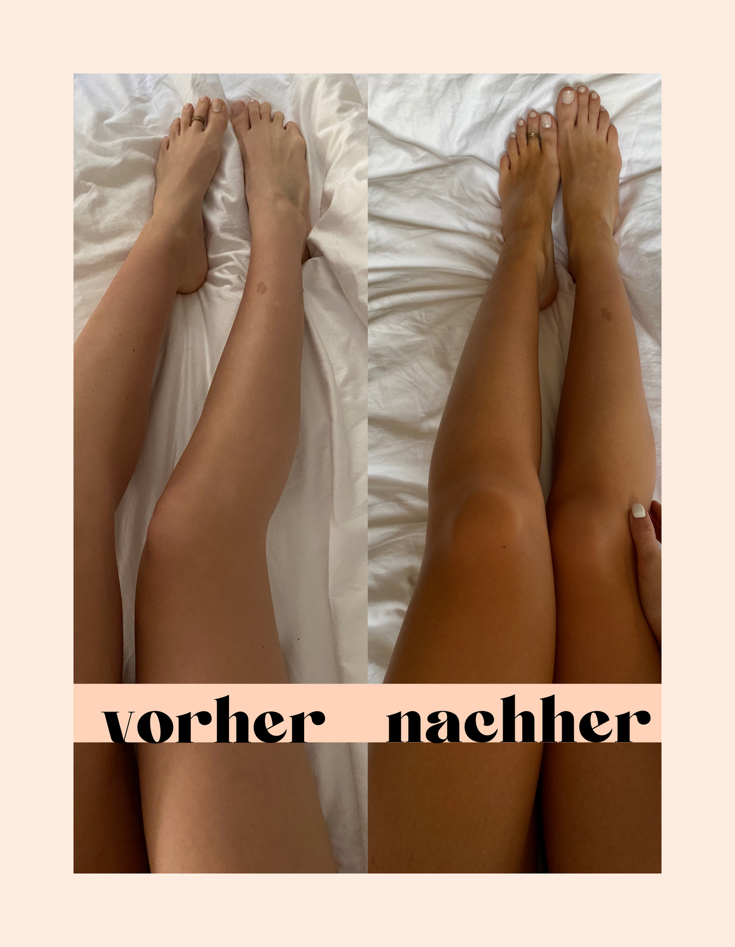 nüdes medium